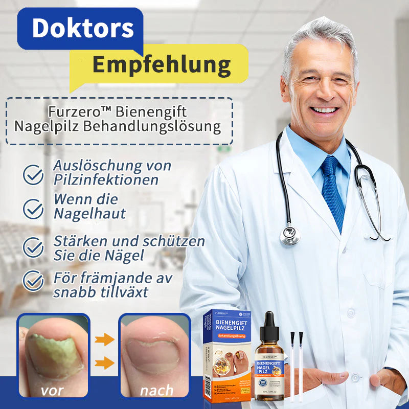 🐝🐝Solución para el tratamiento de hongos en las uñas con veneno de abeja Furzero™: resuelva completamente el problema de los hongos en las uñas🌟👣