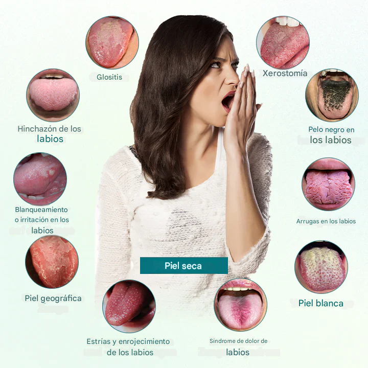 Fivfivgo® GlosShield Spray reparador de lengua