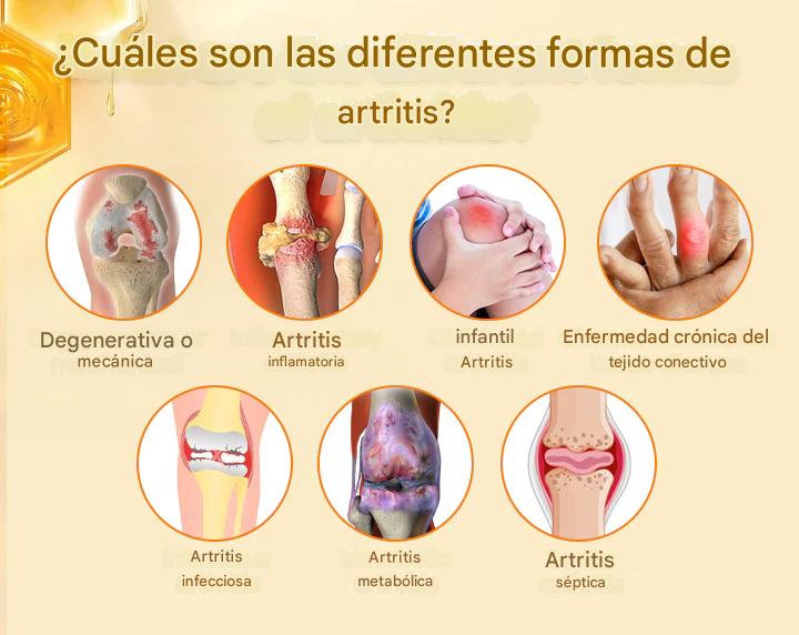 Crema Biancat® para el alivio y la curación del dolor articular con veneno de abeja