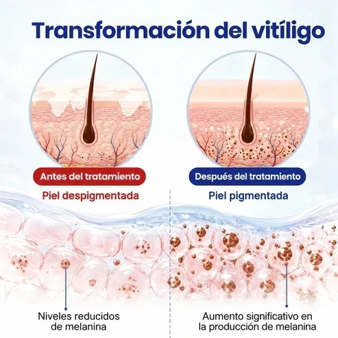 VitiRepair - Spray avanzado para el vitiligo y parches blancos