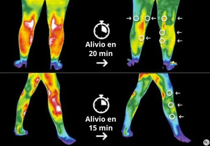 FlexiKnee™️ - Parches naturales para el dolor de rodilla 24 PZS.