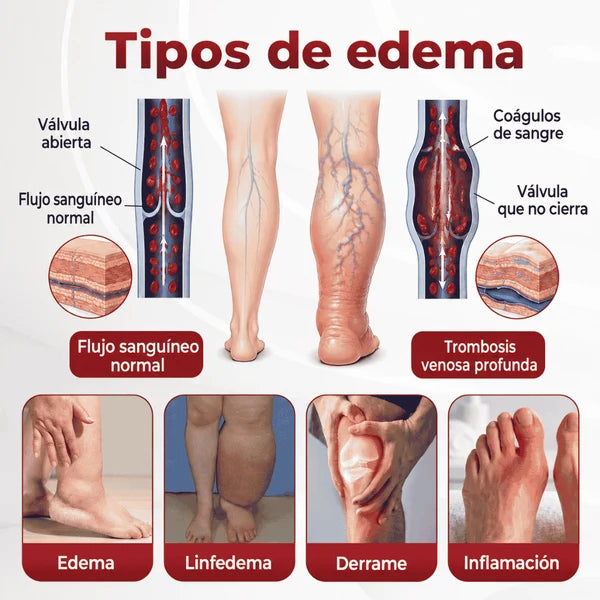 SwellVeil - Crema para la circulación de piernas
