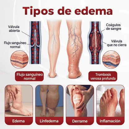 SwellVeil - Crema para la circulación de piernas