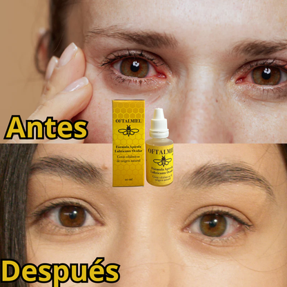OFTALMIEL - Gotas Mágicas Para Recuperar La Vista Y Elimina Las Cataratas