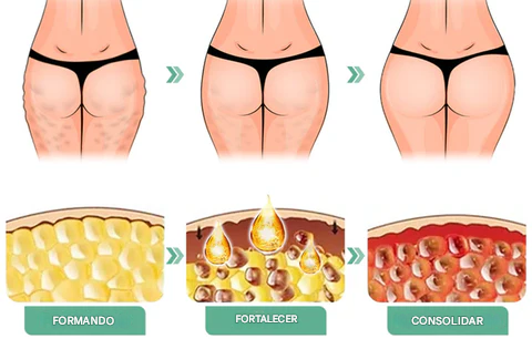 ¡Aceite lifting para glúteos y pecho!