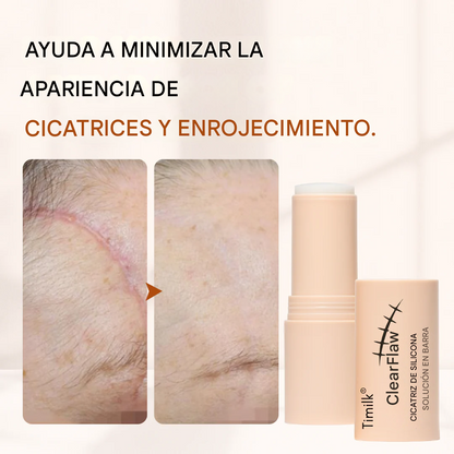 Solución de silicona para cicatrices Timilk® ClearFlaw en barra