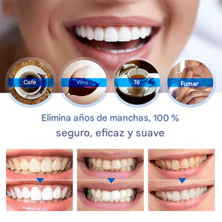 Esencia blanqueadora de dientes