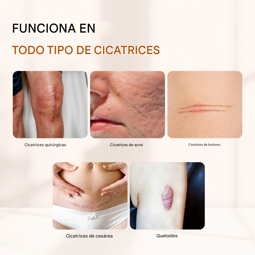 Solución de silicona para cicatrices Timilk® ClearFlaw en barra