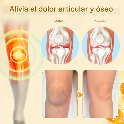 Crema Biancat® para el alivio y la curación del dolor articular con veneno de abeja